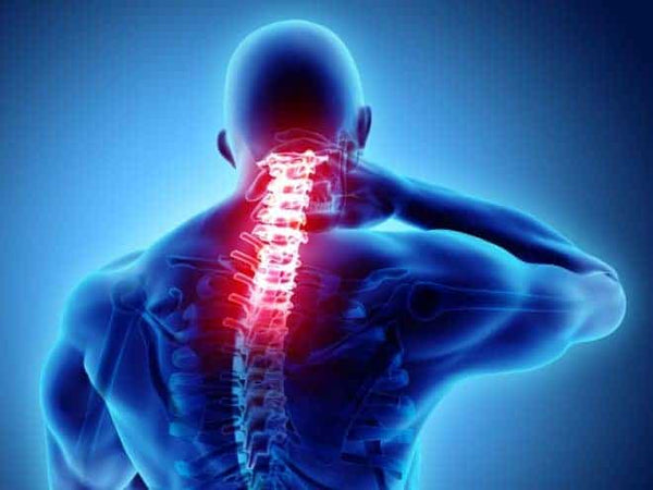 Entorse cervicale: Comment dormir?