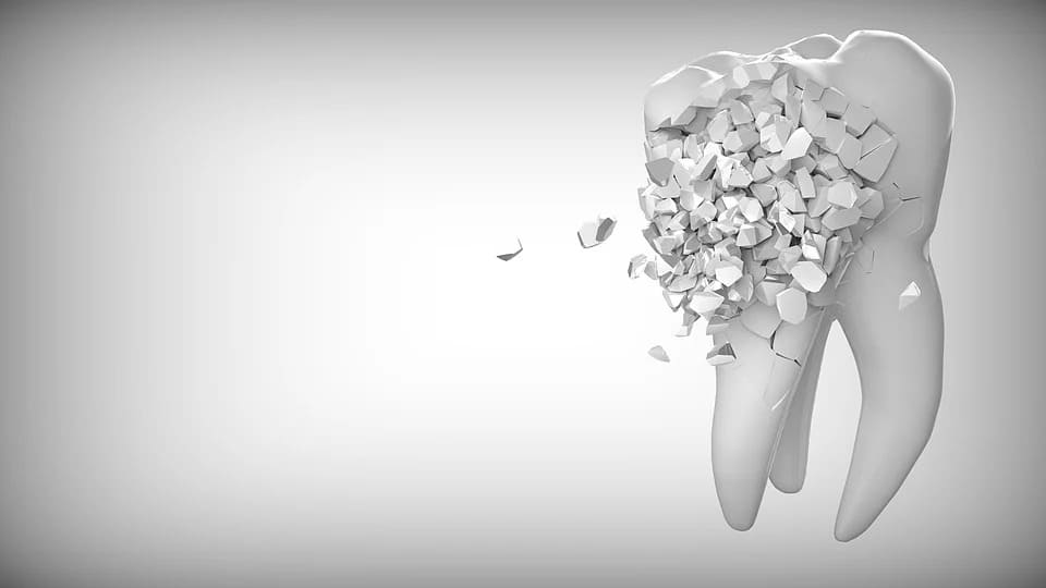 Rêver de dents: Quelles significations?
